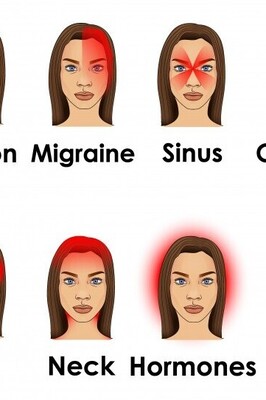 Where Is Migraine Pain Located?