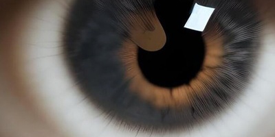 A Woman with Unusual Features Who Protrudes Her Eyes 12 Millimeters