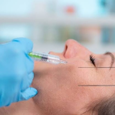 How to Choose the Best Cheek Filler for Your Face Shape