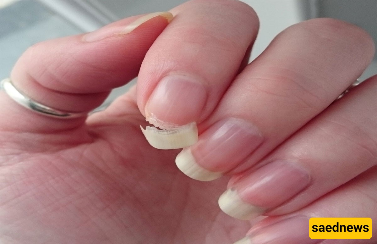 Why Are Your Nails So Brittle? Discover the 10 Key Causes