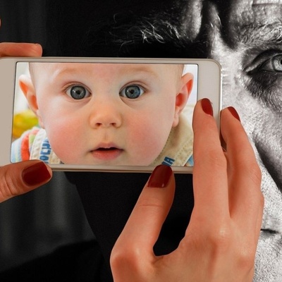 A 4-Year-Old Child Who Looks Like an 80-Year-Old Man