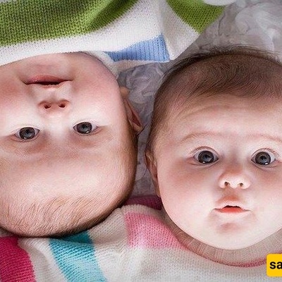 Iran's Strangest Twins: A 10-Year Age Gap! +Photos
