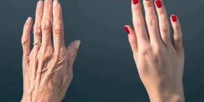 Did You Know That Wrinkling Of The Hands Has Nothing To Do With Aging? You Just Need To Follow These Few Simple Tips.