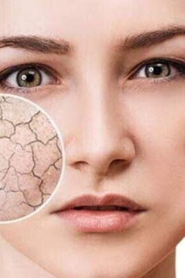 Weekly Skincare Routine for Cold Seasons / 100% Relief from Dry Skin with These 2 Homemade Face Masks