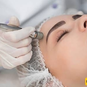 How Does Microdermabrasion Help Rejuvenate the Skin?