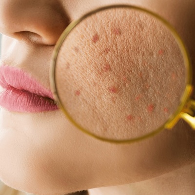 What Items Can Damage Your Skin More Than Makeup Products?