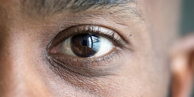 How Can We Strengthen the Muscles of Our Eyes?