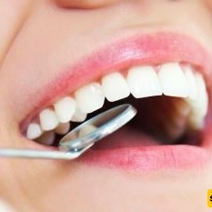 The Difference Between Dental Composite and Veneers | Advantages and Disadvantages of Each