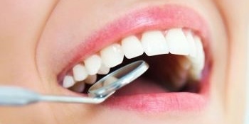 The Difference Between Dental Composite and Veneers | Advantages and Disadvantages of Each