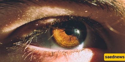 Sunburn Isn’t Just a Skin Problem: The Hidden Risk to Your Eyes