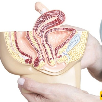 From Back Pain to Urinary Incontinence: Lesser-Known Symptoms of a Tilted Uterus