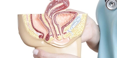 From Back Pain to Urinary Incontinence: Lesser-Known Symptoms of a Tilted Uterus