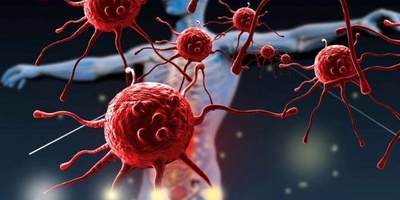 Causes of Autoimmune Diseases and Their Treatment Methods
