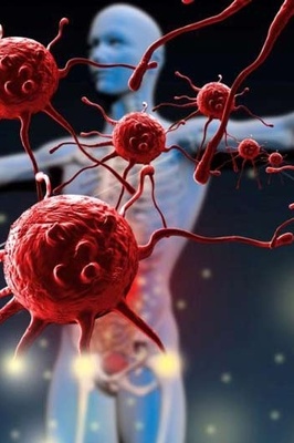 Causes of Autoimmune Diseases and Their Treatment Methods