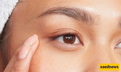 6 Effective Home Remedies for Under-Eye Puffiness: Simple, Practical, and Effective