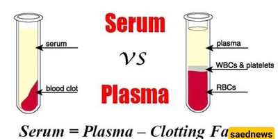 Do You Know the Difference Between Serum and Plasma?