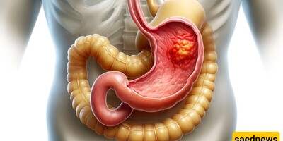 8 Important Symptoms Of A Stomach Ulcer + The Best Home And Natural Remedies / What Is The Best Pill For A Stomach Ulcer?