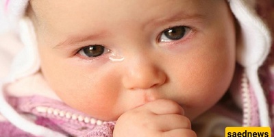 Causes of Excessive Tearing in Children and Treatment Methods
