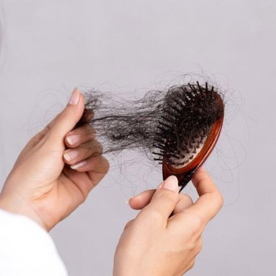 Why Hair Falls Out More During Certain Seasons Causes and Effective Solutions