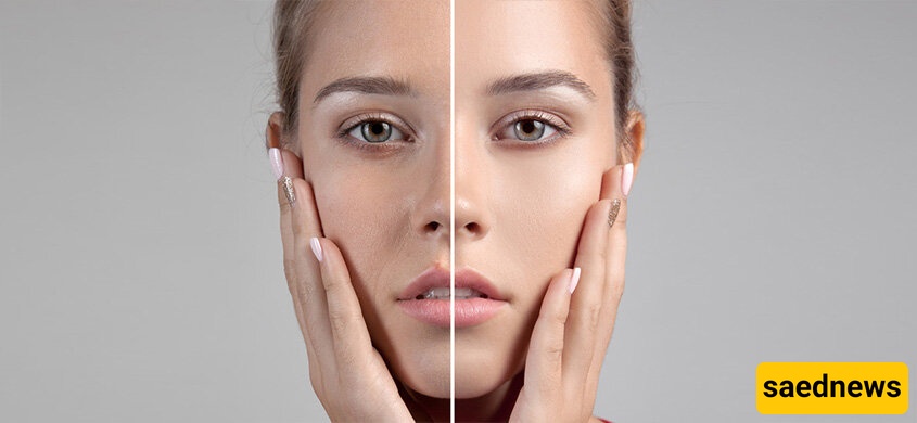 Collagen 