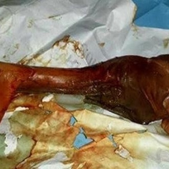 The Strange Story of a Woman Who Gave Birth to a Rabbit