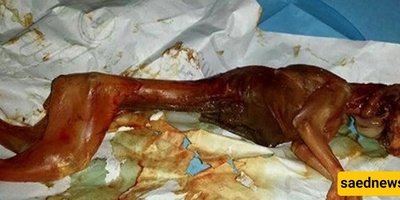 The Strange Story of a Woman Who Gave Birth to a Rabbit