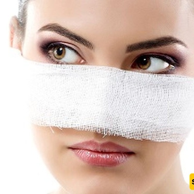 A Young Woman’s Strange Shock After Her Nose Surgery