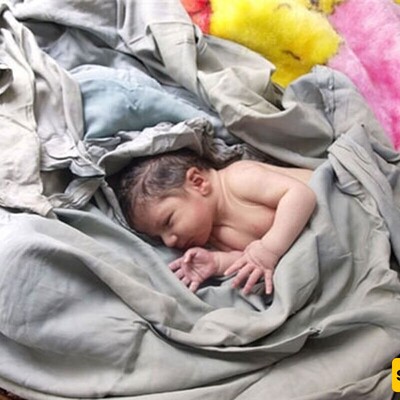 Image | A Mother Who Sold Her 5-day-old Baby For Her Own Nose Cosmetic Surgery!