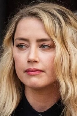 Amber Heard Uses a Cane After Her Divorce from Johnny Depp +Photo