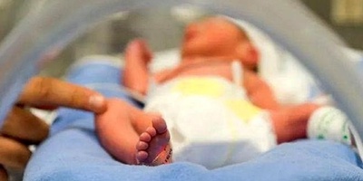 Fetus Swallowed Its Twin: Surgery Removes Deceased Fetus