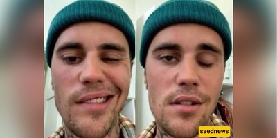 Justin Bieber Shared A Health Update With Fans By Posting A Video Of Himself Moving Both Sides Of His Face After He Suffered From Facial Paralysis Last Year