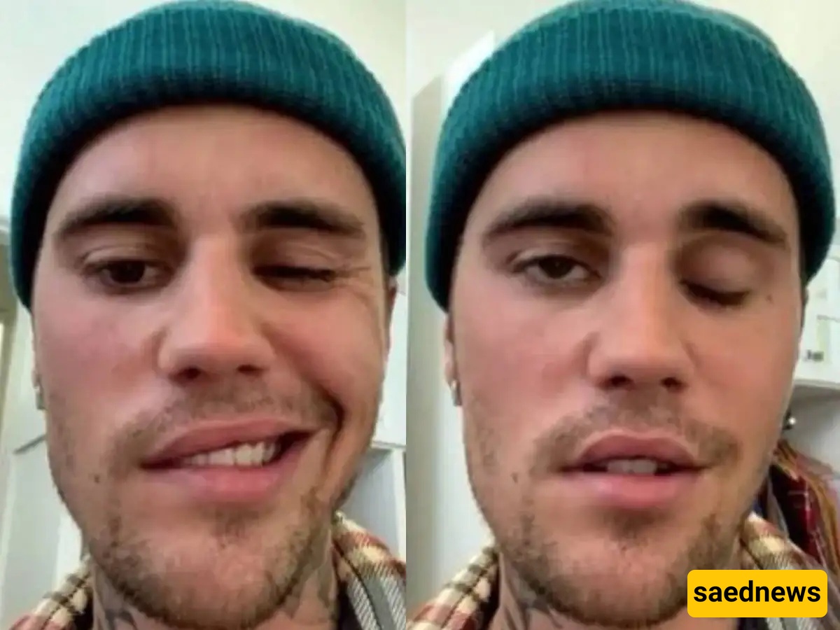 Justin Bieber Shared A Health Update With Fans By Posting A Video Of Himself Moving Both Sides Of His Face After He Suffered From Facial Paralysis Last Year