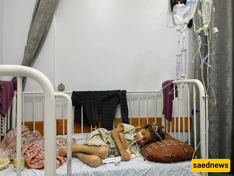 Children in Gaza Are Dying of Malnutrition, local Authorities Report