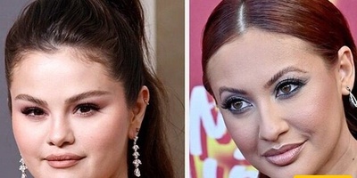 Selena Gomez Reconciles with Her Kidney Donor