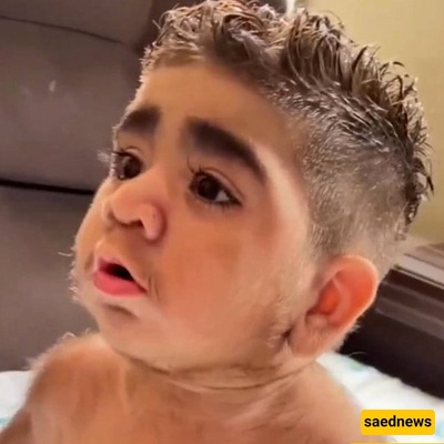 This Baby Was Born at 35 Years Old; Mother Faints and Loses Consciousness (Video)