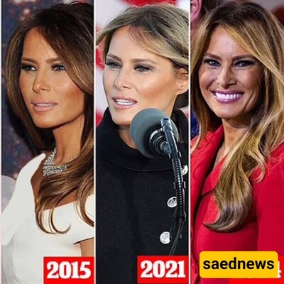 How Melania Trump Defies Time and Stays Ageless After Two Decades? You Won't Believe it!