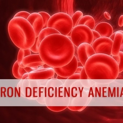 Causes Of “Iron Deficiency Anemia”