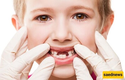 The Importance of Baby Teeth and Their Impact on Permanent Teeth / When Should I Take My Child to the Dentist?