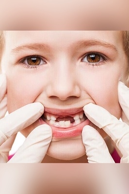 The Importance of Baby Teeth and Their Impact on Permanent Teeth / When Should I Take My Child to the Dentist?