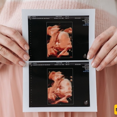 The Only Taste A Fetus Can Recognize In The Mother’s Womb