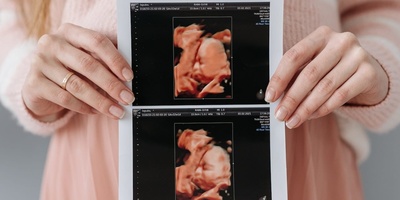 The Only Taste A Fetus Can Recognize In The Mother’s Womb