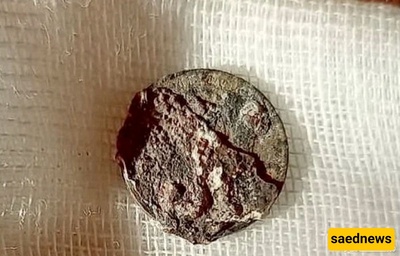 The Man Who Lived Half A Century With A Coin In His Nose