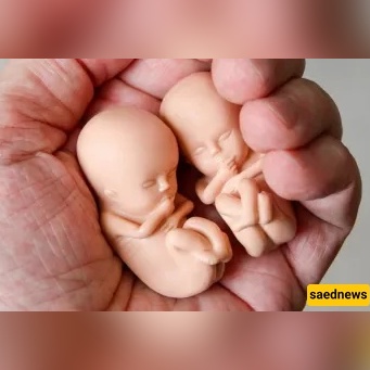 Abortion Without the Husband’s Consent(Legal and Religious Rulings)