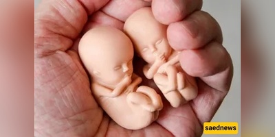 Abortion Without the Husband’s Consent(Legal and Religious Rulings)