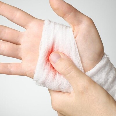 Useful and Effective Ways to Prevent Wound Bleeding