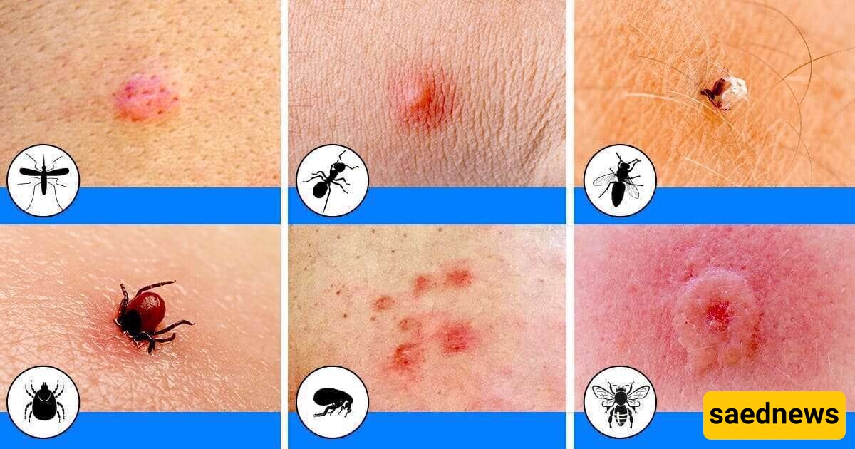 Effective Home Remedies for Relieving and Treating Flea Bites Itching in the Fastest Time.