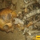 A Man’s Leg Stuck Out of a Neighbor’s Grave + Photo