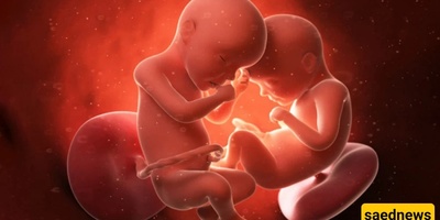 Fetus Emerging From the Head of Its Twin Sister Inside the Mother’s Womb + Ultrasound Image