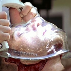 Astonishing Image of a Human Face Detached for Transplant — Warning: Extremely Disturbing