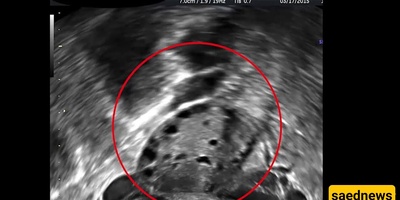 Adorable Ultrasound Image of a Pregnant Monkey